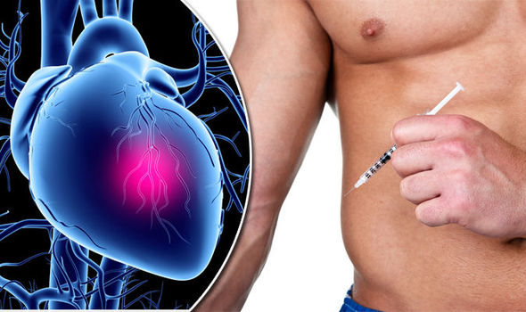 Efectele steroizilor anabolizanti asupra inimii